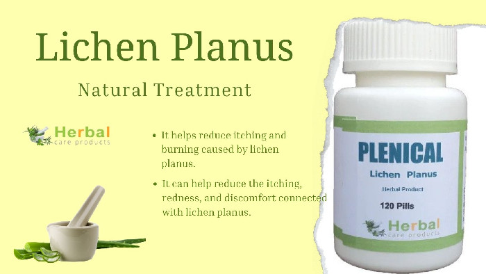 Fight Lichen Planus Naturally: Top Remedies for Clearer Skin :: Herbal-care-products