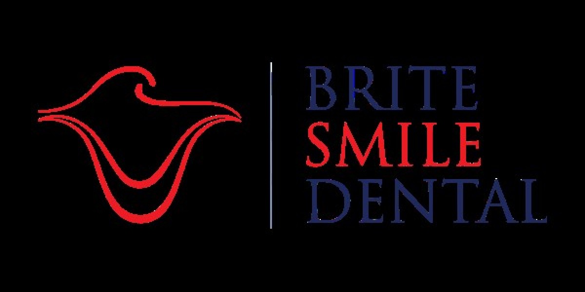 Dental veneers San Diego- Brite Smile Dental