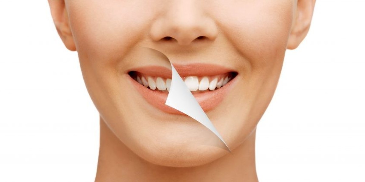 Achieve a Perfect Smile with Cosmetic Laser Dentistry