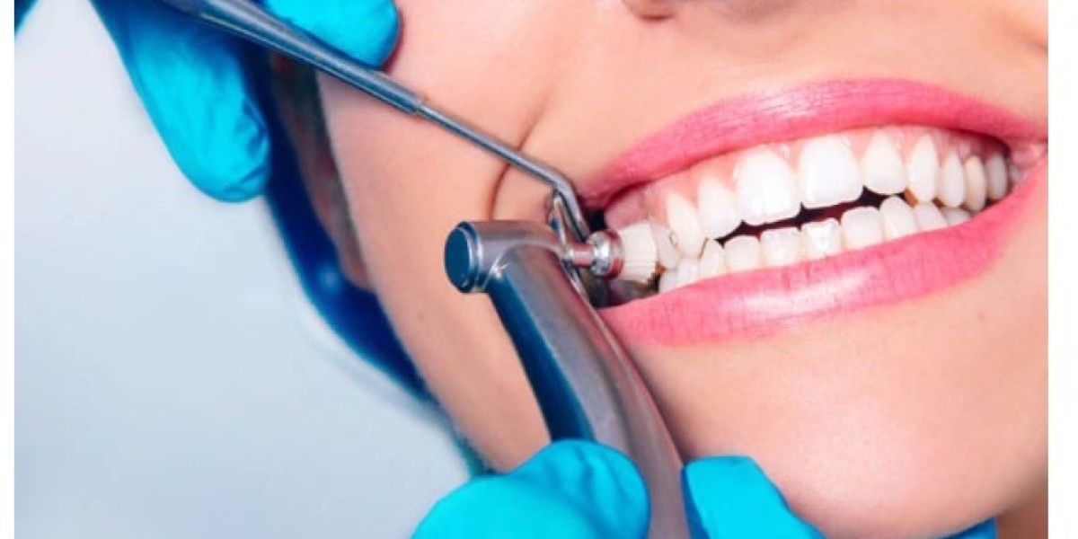 The Complete Guide to Dental Cleaning: Keep Your Smile Healthy and Bright